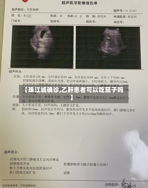 【珠江城确诊,乙肝患者可以吃茄子吗】