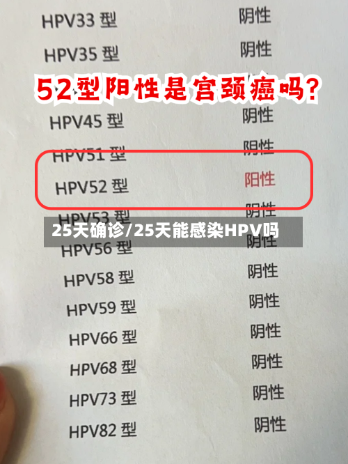 25天确诊/25天能感染HPV吗