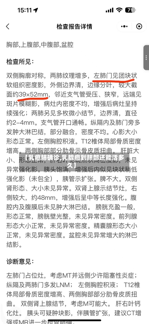 【乳癌肺确诊,乳腺癌到肺部还能活多久】-第2张图片