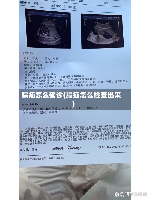 膈疝怎么确诊(膈疝怎么检查出来)