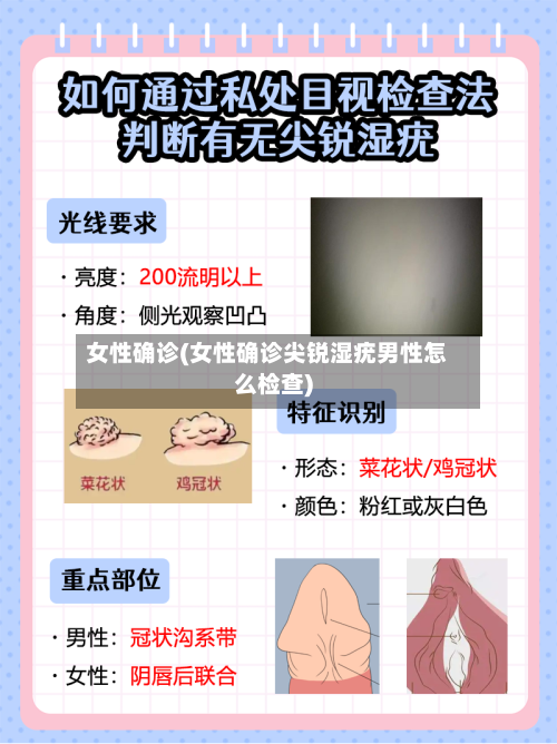 女性确诊(女性确诊尖锐湿疣男性怎么检查)