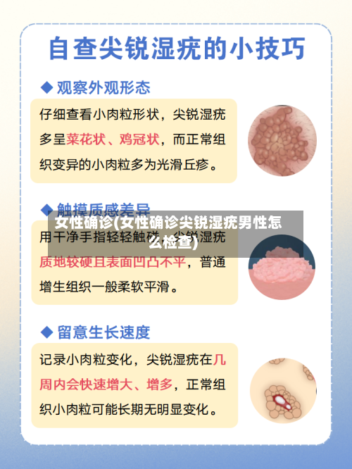 女性确诊(女性确诊尖锐湿疣男性怎么检查)-第2张图片