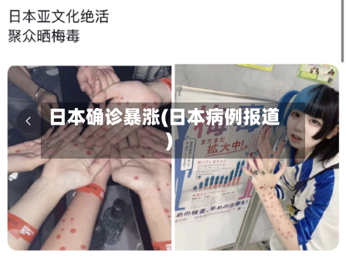 日本确诊暴涨(日本病例报道)-第2张图片