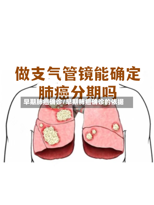 早期肺癌确诊/早期肺癌确诊的依据-第2张图片