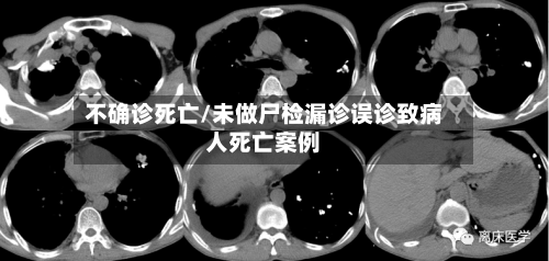 不确诊死亡/未做尸检漏诊误诊致病人死亡案例-第2张图片