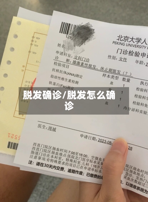 脱发确诊/脱发怎么确诊-第2张图片