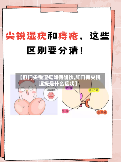 【肛门尖锐湿疣如何确诊,肛门有尖锐湿疣是什么症状】-第2张图片