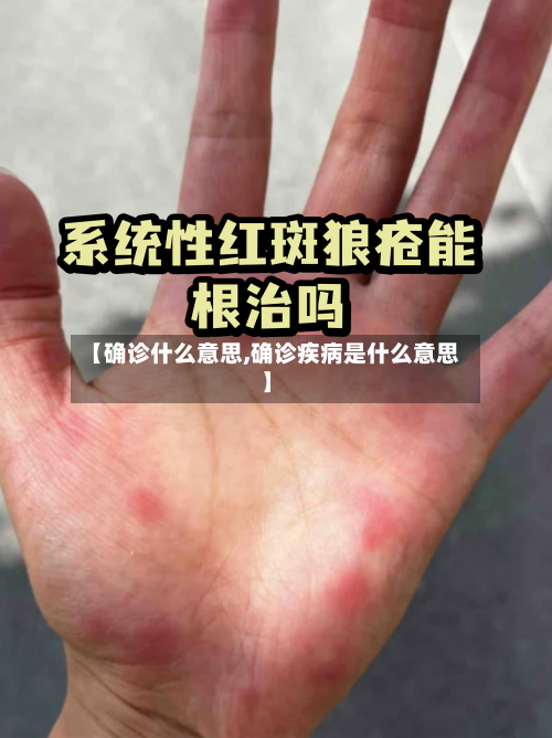 【确诊什么意思,确诊疾病是什么意思】
