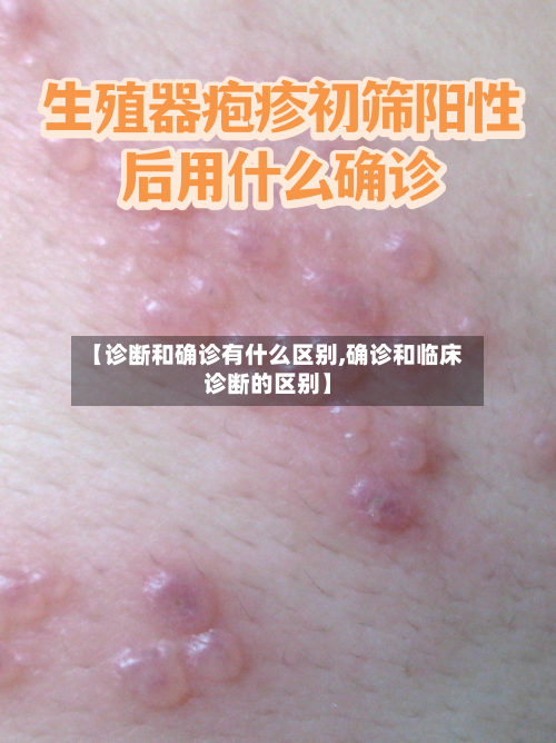 【诊断和确诊有什么区别,确诊和临床诊断的区别】-第3张图片