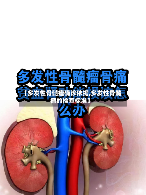 【多发性骨髓瘤确诊依据,多发性骨髓瘤的检查标准】