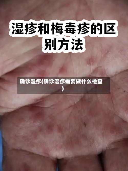 确诊湿疹(确诊湿疹需要做什么检查)