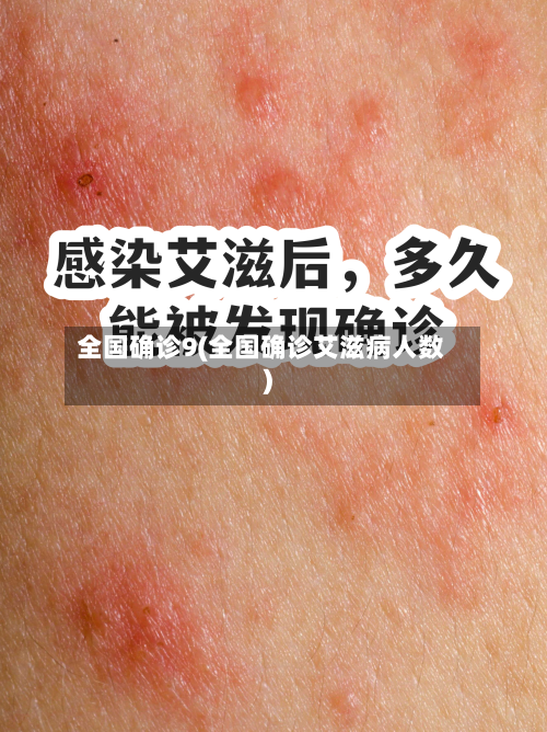 全国确诊9(全国确诊艾滋病人数)
