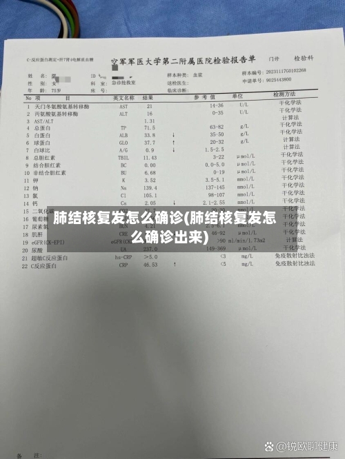 肺结核复发怎么确诊(肺结核复发怎么确诊出来)