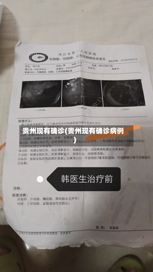 贵州现有确诊(贵州现有确诊病例)