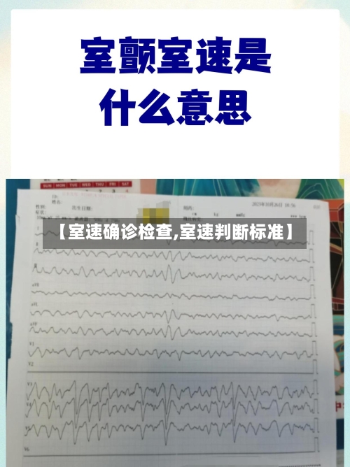 【室速确诊检查,室速判断标准】