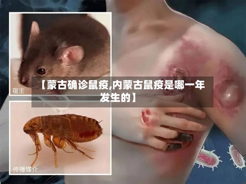 【蒙古确诊鼠疫,内蒙古鼠疫是哪一年发生的】-第2张图片