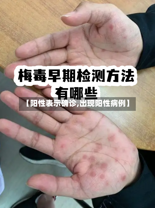 【阳性表示确诊,出现阳性病例】