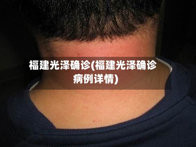 福建光泽确诊(福建光泽确诊病例详情)