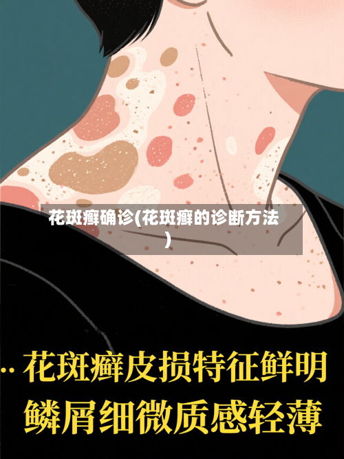 花斑癣确诊(花斑癣的诊断方法)-第3张图片