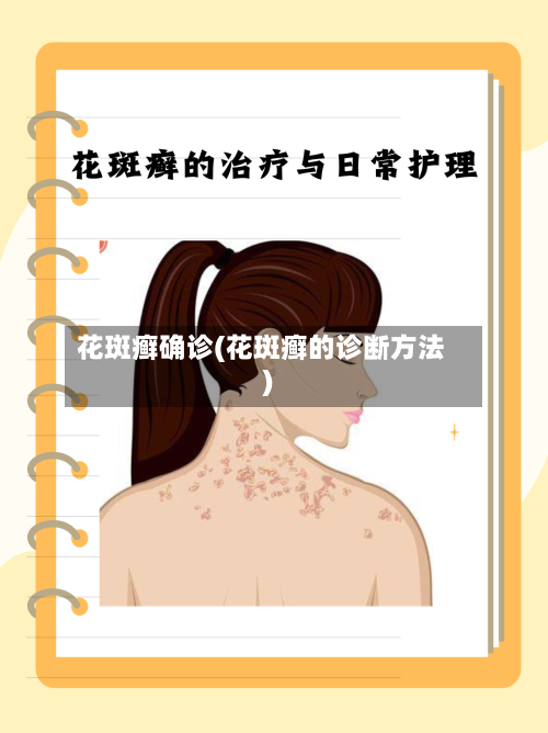 花斑癣确诊(花斑癣的诊断方法)-第2张图片