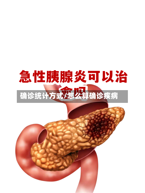 确诊统计方式/怎么算确诊疾病