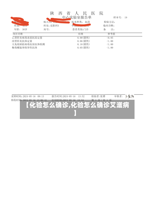 【化验怎么确诊,化验怎么确诊艾滋病】