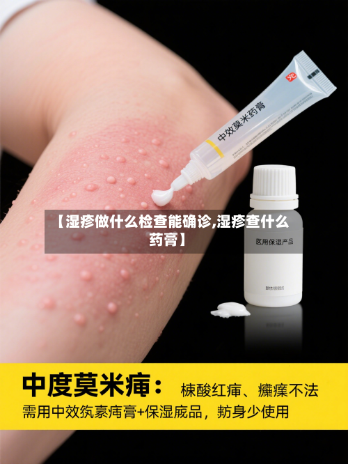 【湿疹做什么检查能确诊,湿疹查什么药膏】-第2张图片