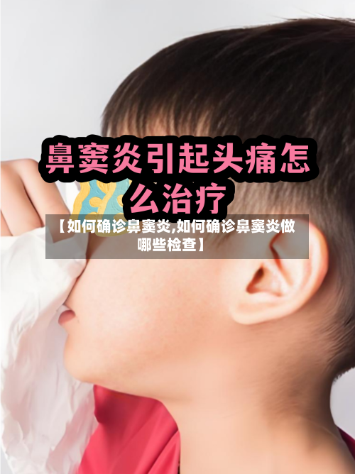 【如何确诊鼻窦炎,如何确诊鼻窦炎做哪些检查】-第2张图片