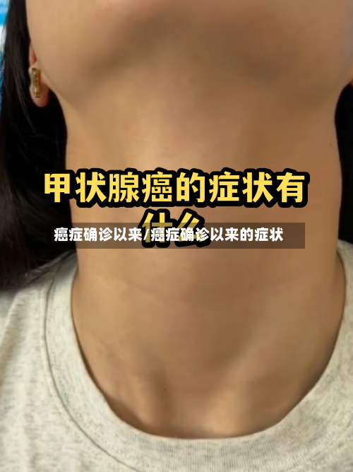 癌症确诊以来/癌症确诊以来的症状