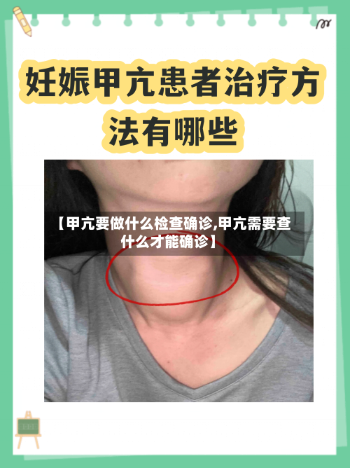 【甲亢要做什么检查确诊,甲亢需要查什么才能确诊】-第2张图片