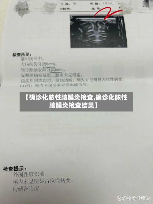 【确诊化脓性脑膜炎检查,确诊化脓性脑膜炎检查结果】-第2张图片