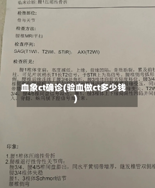 血象ct确诊(验血做ct多少钱)-第3张图片