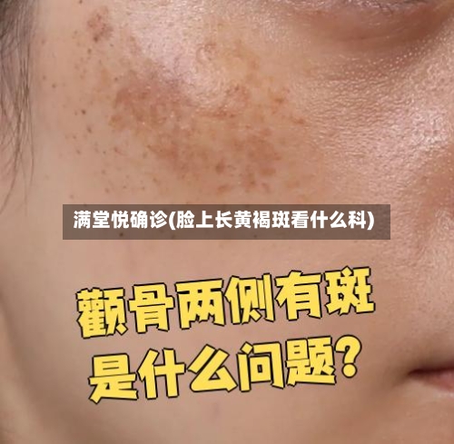 满堂悦确诊(脸上长黄褐斑看什么科)