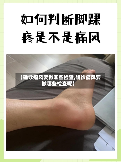 【确诊痛风要做哪些检查,确诊痛风要做哪些检查呢】-第3张图片
