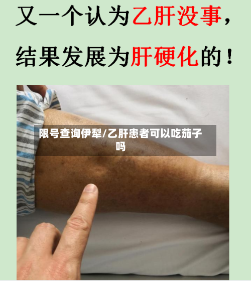 限号查询伊犁/乙肝患者可以吃茄子吗
