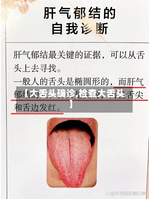 【大舌头确诊,检查大舌头】