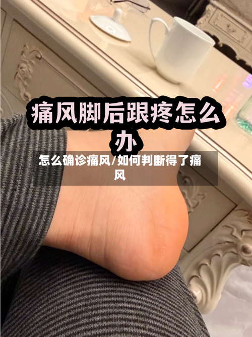 怎么确诊痛风/如何判断得了痛风-第3张图片