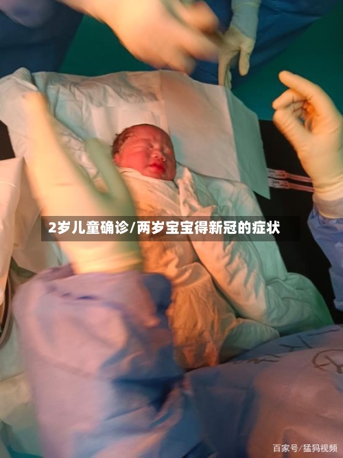 2岁儿童确诊/两岁宝宝得新冠的症状