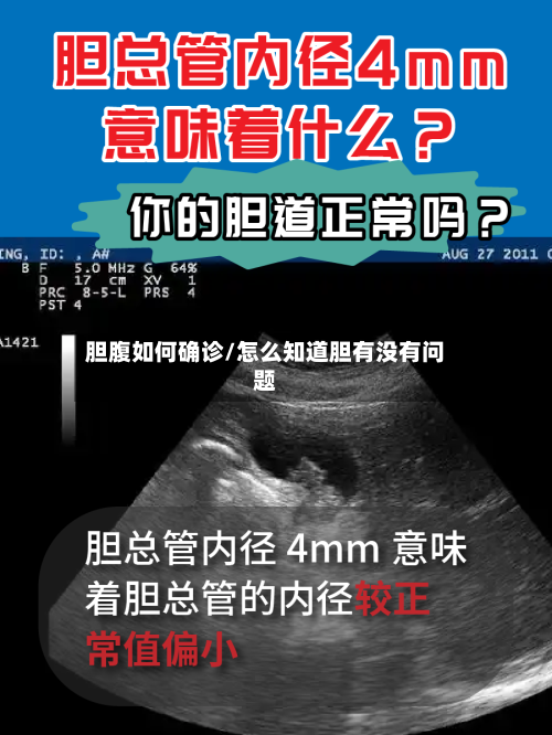 胆腹如何确诊/怎么知道胆有没有问题-第2张图片
