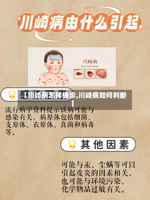 【川崎病怎样确诊,川崎病如何判断】
