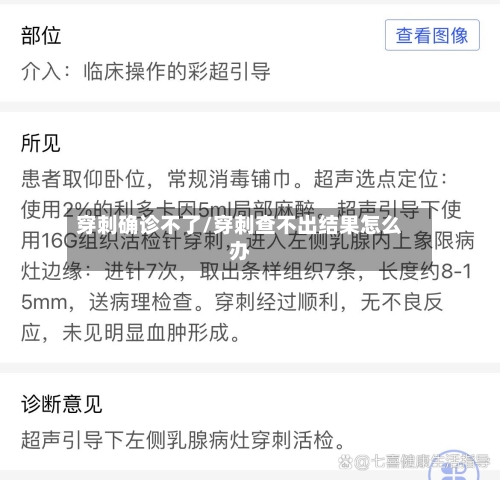 穿刺确诊不了/穿刺查不出结果怎么办-第2张图片