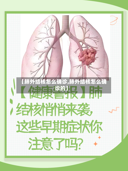 【肺外结核怎么确诊,肺外结核怎么确诊的】-第2张图片