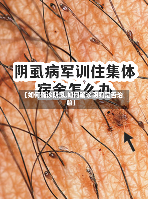 【如何确诊阴虱,如何确诊阴虱是否治愈】