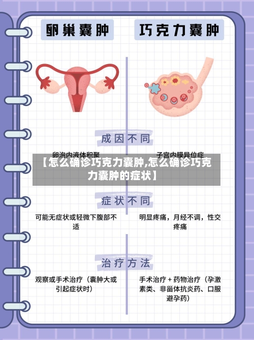【怎么确诊巧克力囊肿,怎么确诊巧克力囊肿的症状】-第2张图片