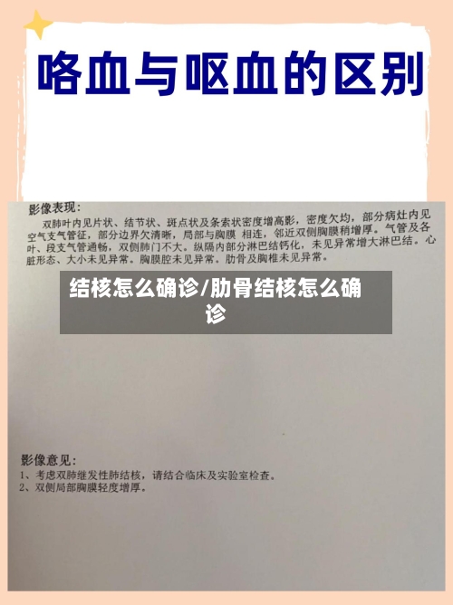 结核怎么确诊/肋骨结核怎么确诊