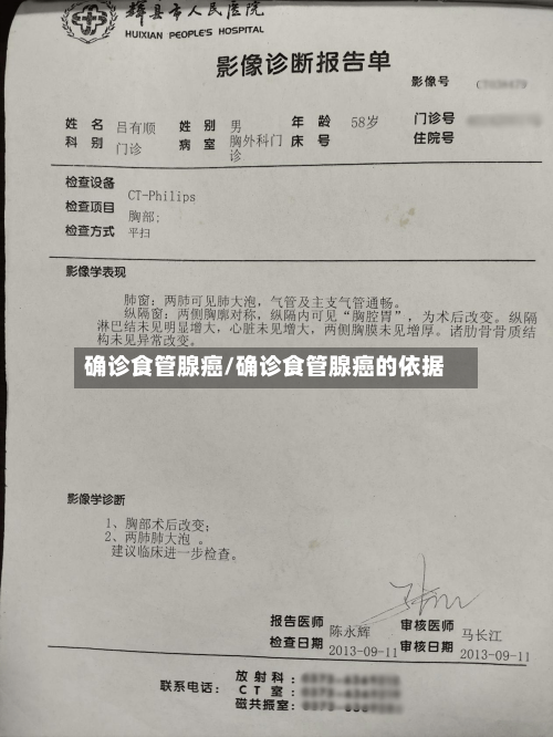 确诊食管腺癌/确诊食管腺癌的依据
