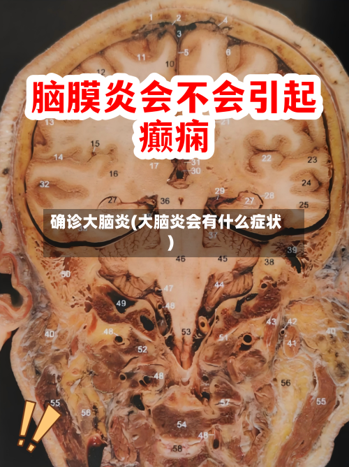 确诊大脑炎(大脑炎会有什么症状)-第2张图片