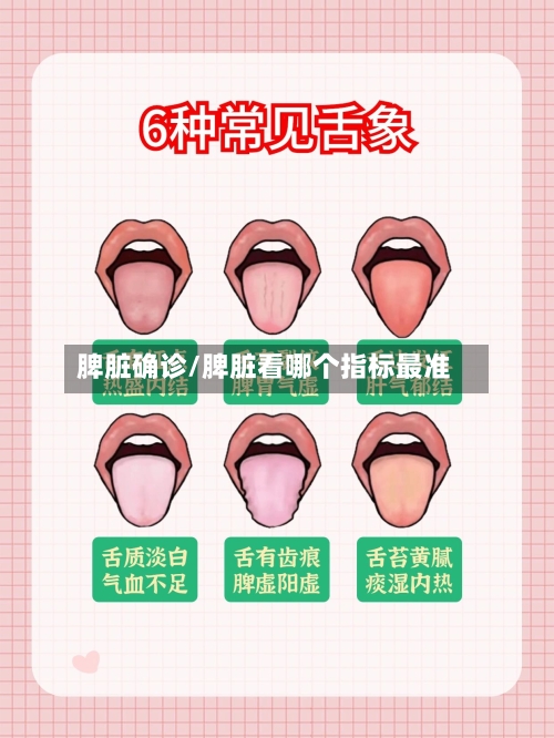 脾脏确诊/脾脏看哪个指标最准-第3张图片