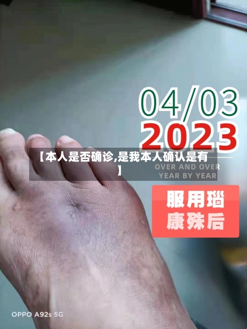 【本人是否确诊,是我本人确认是有】-第2张图片
