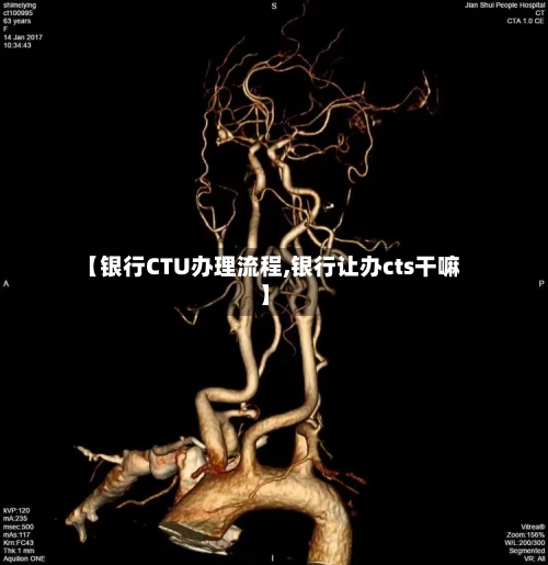【银行CTU办理流程,银行让办cts干嘛】-第2张图片
